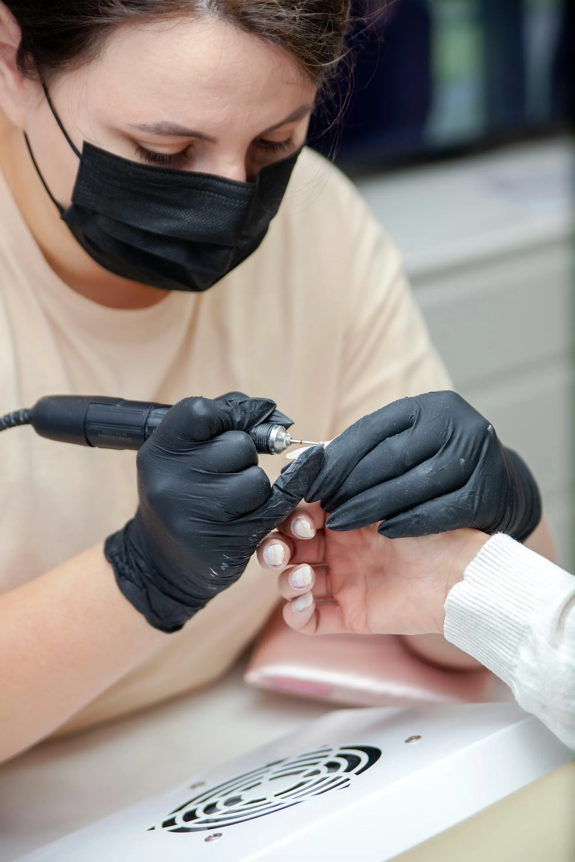 Gel-X transformation — before